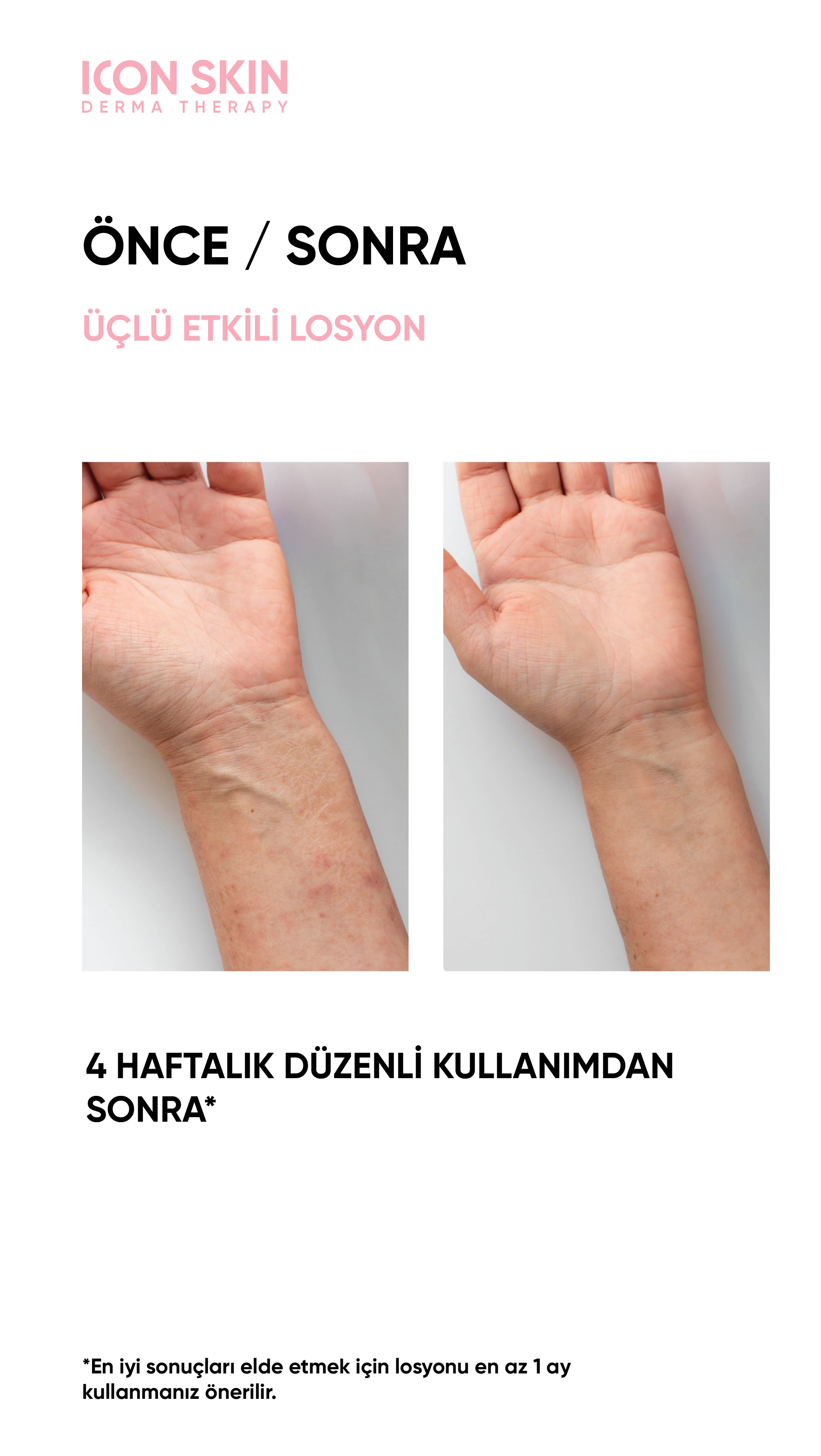 AtopiDerm Barier 0+ Atopik Ciltler için Üçlü Etki Yüz&Vücüt Bakım Losyonu